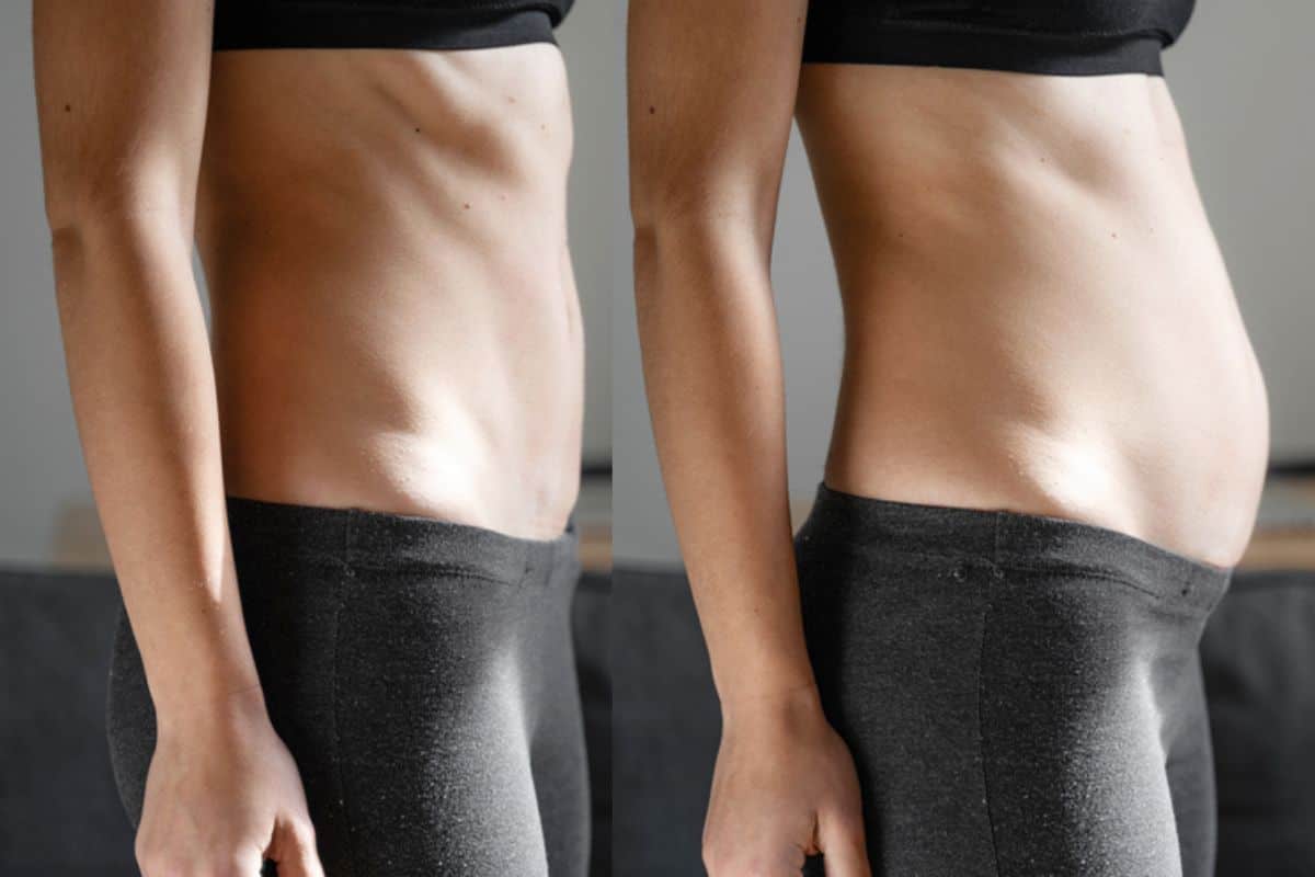 How long does diastasis recti take to improve Surrey?