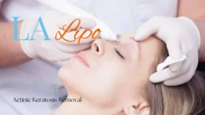 Woman receiving Actinic Keratosis Removal Treatment Surrey