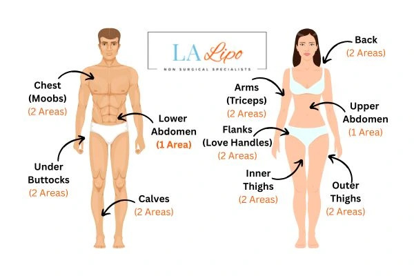 LA LIPO Cryolipolysis Areas Surrey