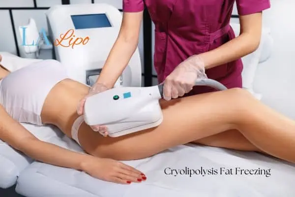 Woman receiving coolsculpting Surrey treatment on her thighs