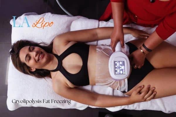 woman getting cryolipolysis Surrey