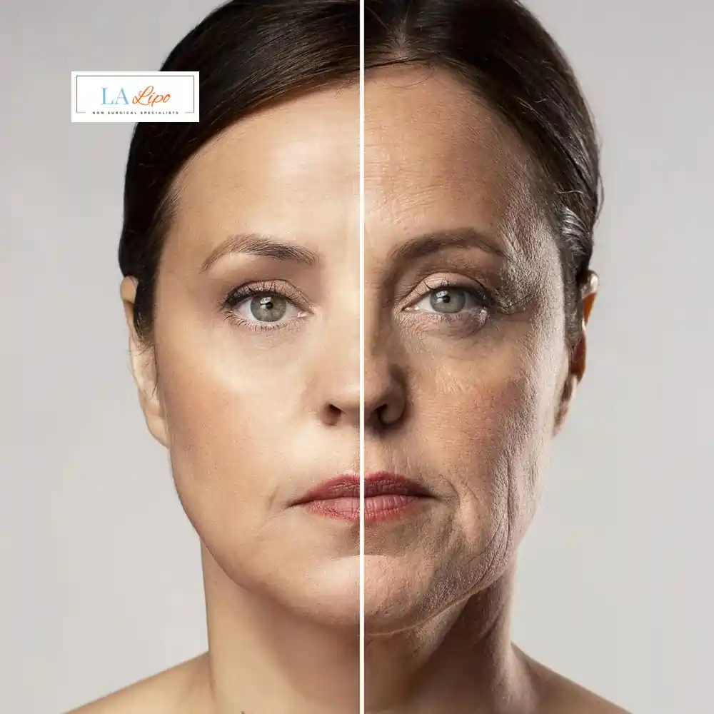 How Can You Tell If Non-Surgical Skin Tightening Is Right for You Surrey?