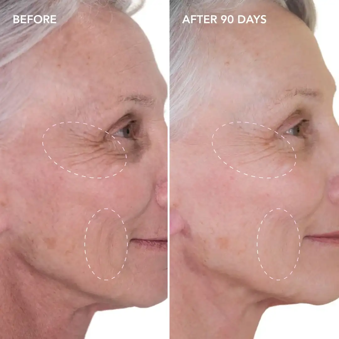 When will you see results Surrey